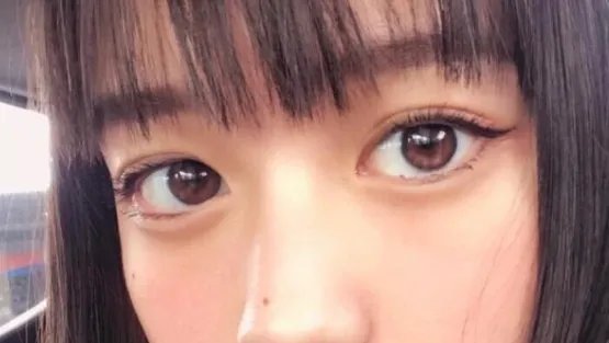 去眼袋医院哪家好