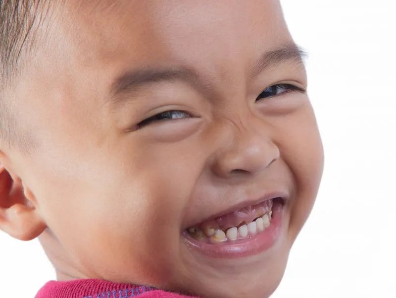 脊髓灰质炎后遗症的治疗