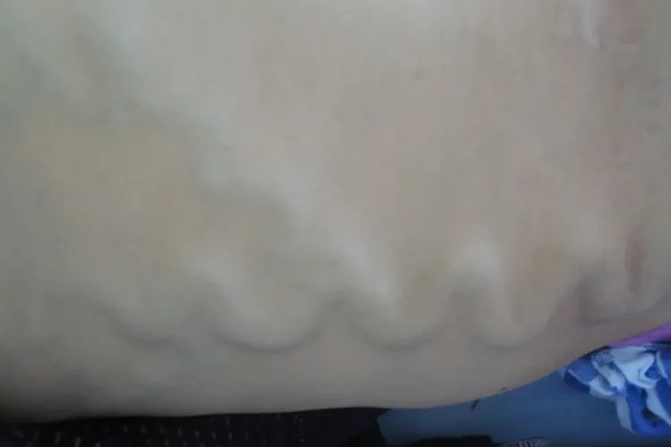 肝不好都有什么样的症状和反应