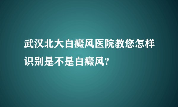 武汉北大白癜风医院教您怎样识别是不是白癜风?