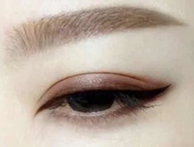 割双眼皮手术哪里比较好