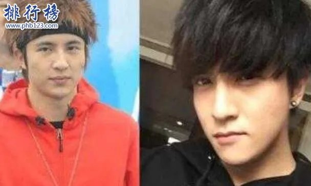 娱乐圈十大承认整容明星，最后一个让人唏嘘不已