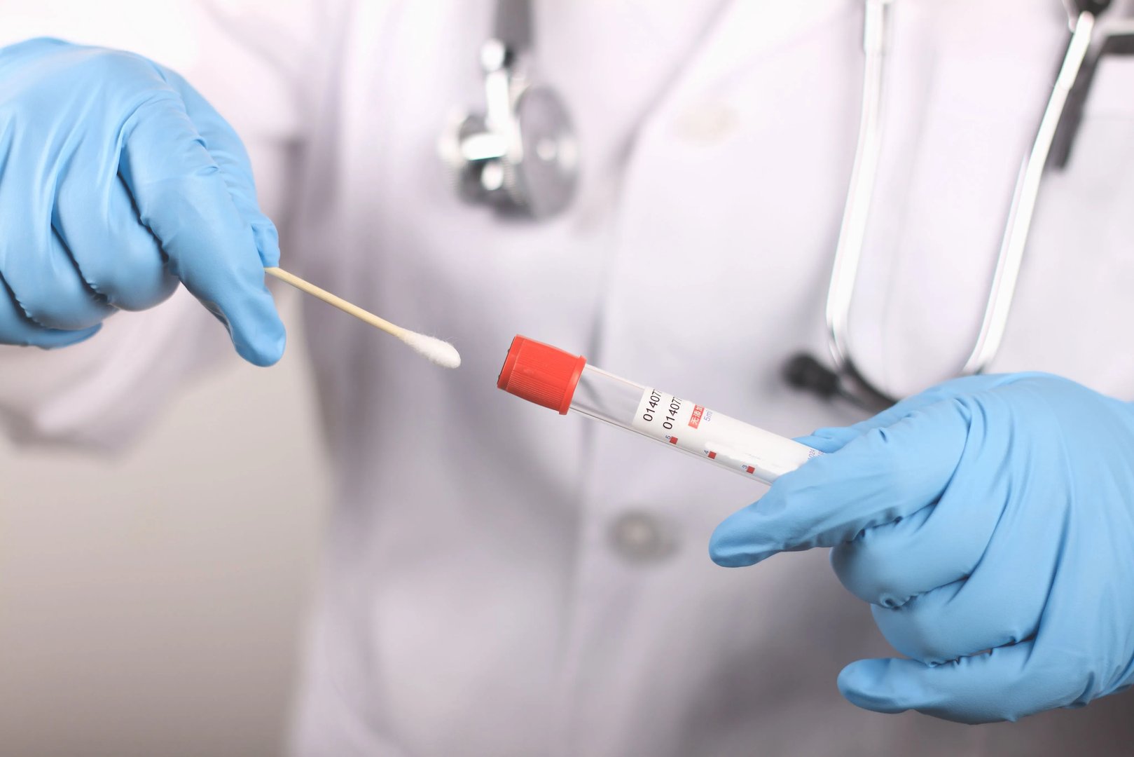 核酸检测是阳性怎么办