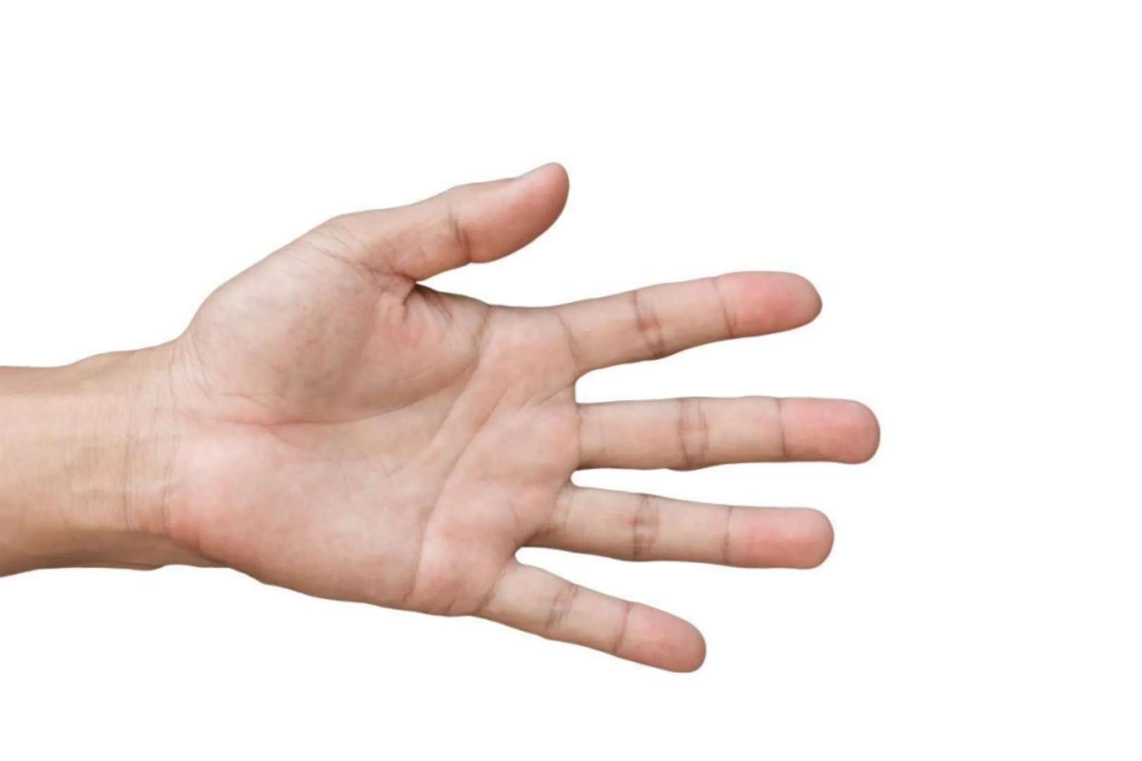 手诊看疾病图解