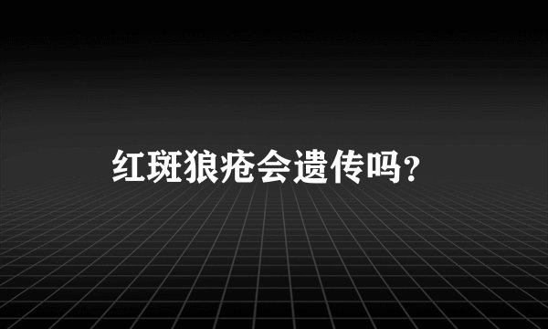 红斑狼疮会遗传吗？