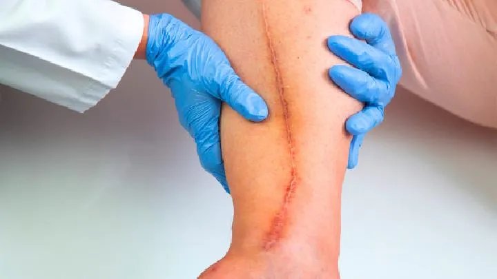 修复疤痕的方法都有哪些