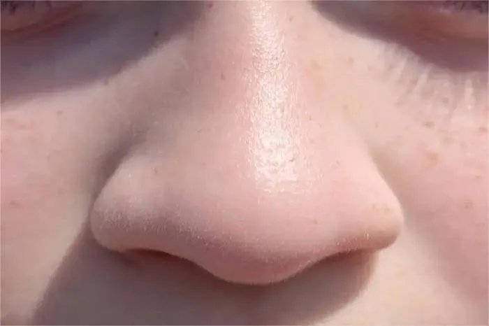 正常人的鼻子图片