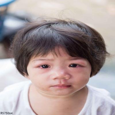 被蜂蛰伤后的处理方法有哪些