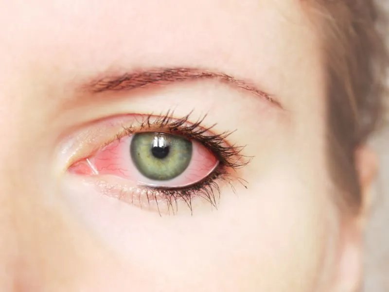 四环素可的松眼膏的作用