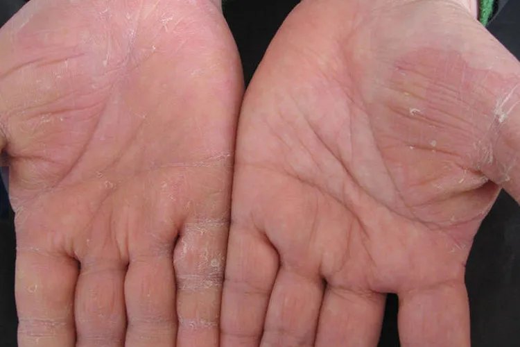 手气图片大全图片