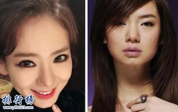 娱乐圈十大承认整容明星，最后一个让人唏嘘不已