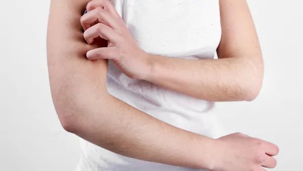 皮肤过敏的症状