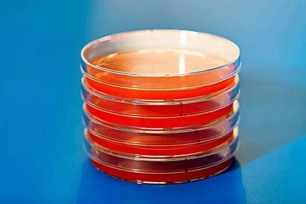 配制培养基的步骤？