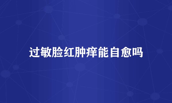 过敏脸红肿痒能自愈吗