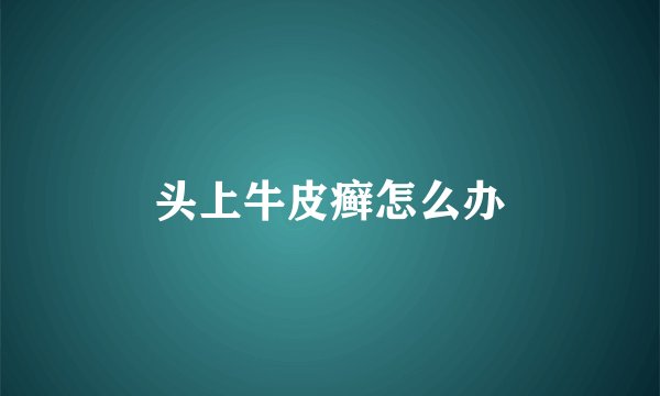 头上牛皮癣怎么办