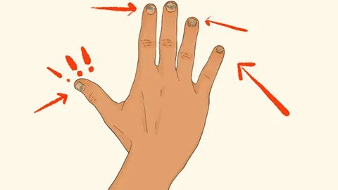 指甲表面凹凸不平是什么原因