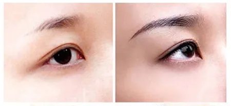 现在文眉多少钱