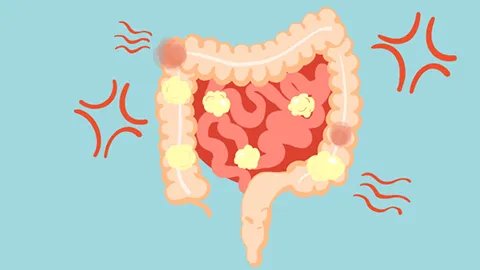 肛门痛痒是怎么回事