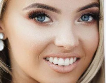 医院激光祛斑多少钱