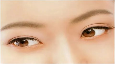 北京做去眼袋手术要多少钱