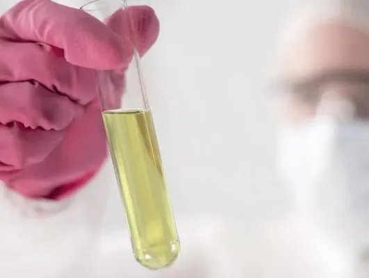 如何解读尿检报告