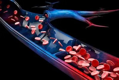 甘油三酯高吃什么好 甘油三酯高饮食注意三点