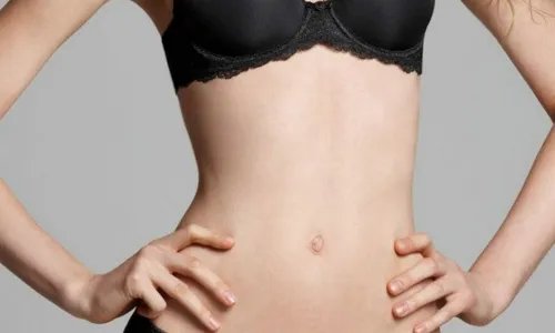 剖腹产的疤痕能去掉吗