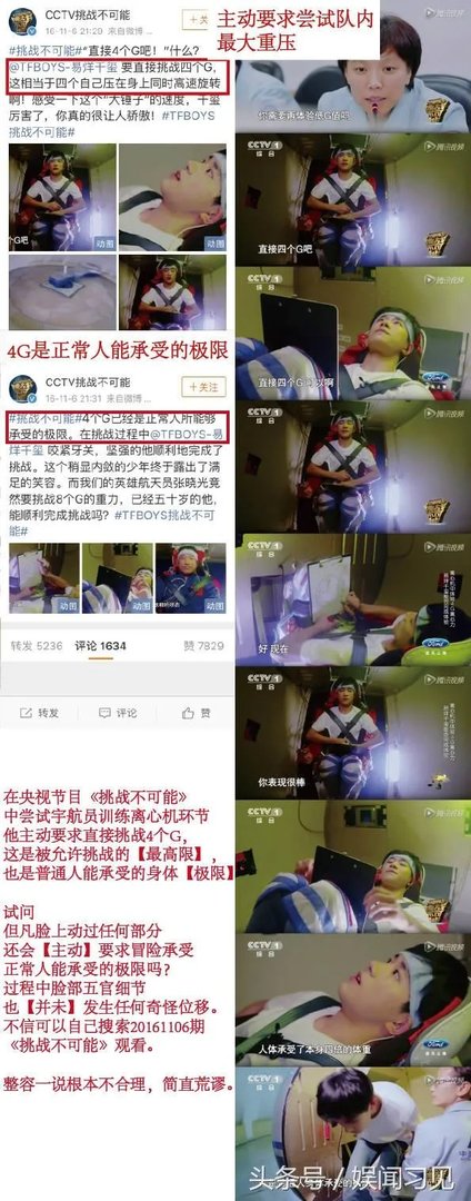 易烊千玺整容了吗？