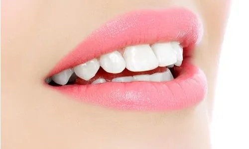牙齿美白一般要多少钱