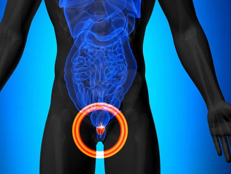 前列腺素A是什么