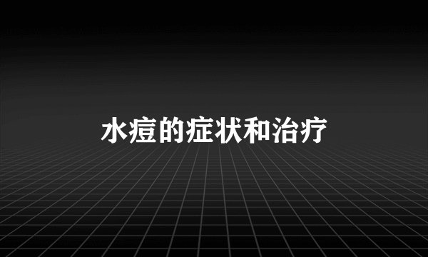 水痘的症状和治疗