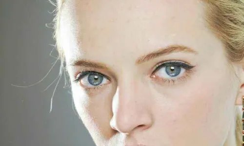 鼻小柱延长的坏处