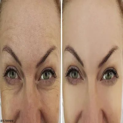 白醋可以美白吗