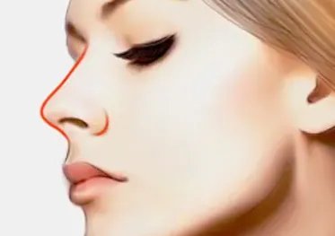 鼻尖缩小价格