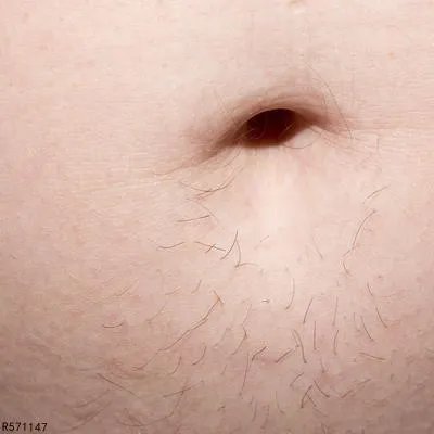 肚脐眼有臭味怎么办