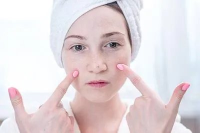 哪种祛斑产品效果最好