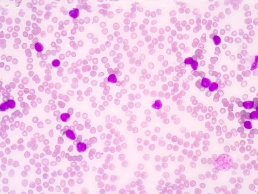 苯酚的用途是什么