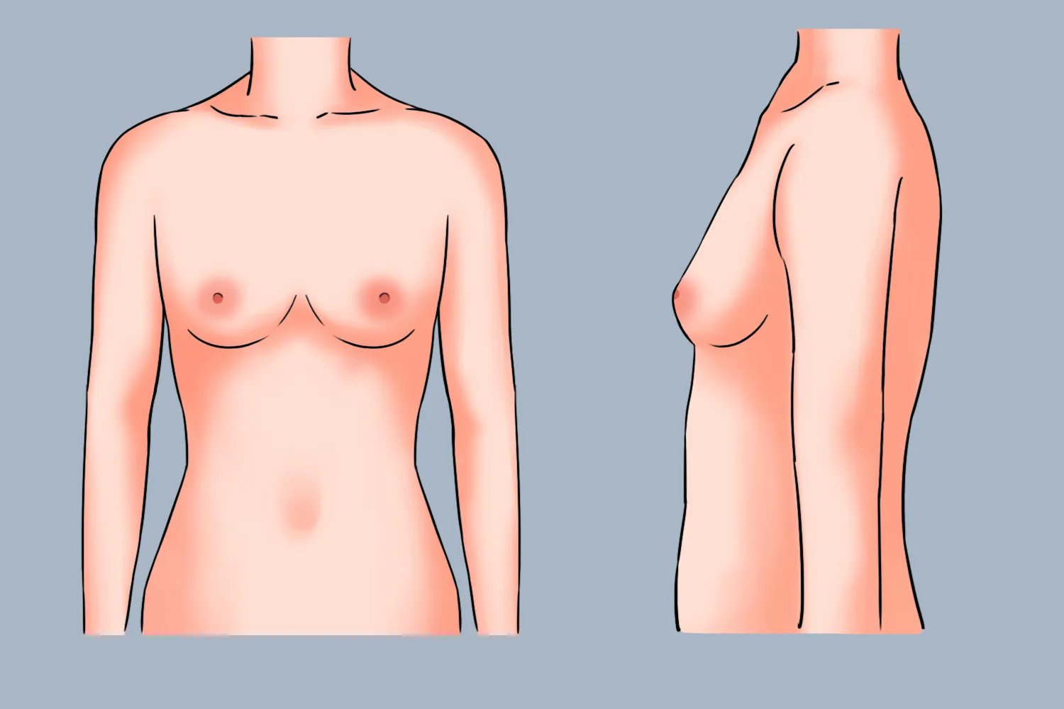 九岁半女孩胸部发育的图片