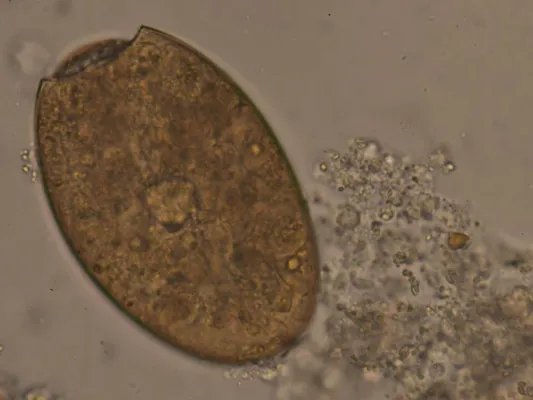 人体寄生虫的危害