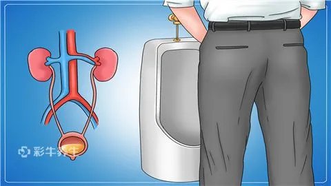 尿失禁怎么治疗呢