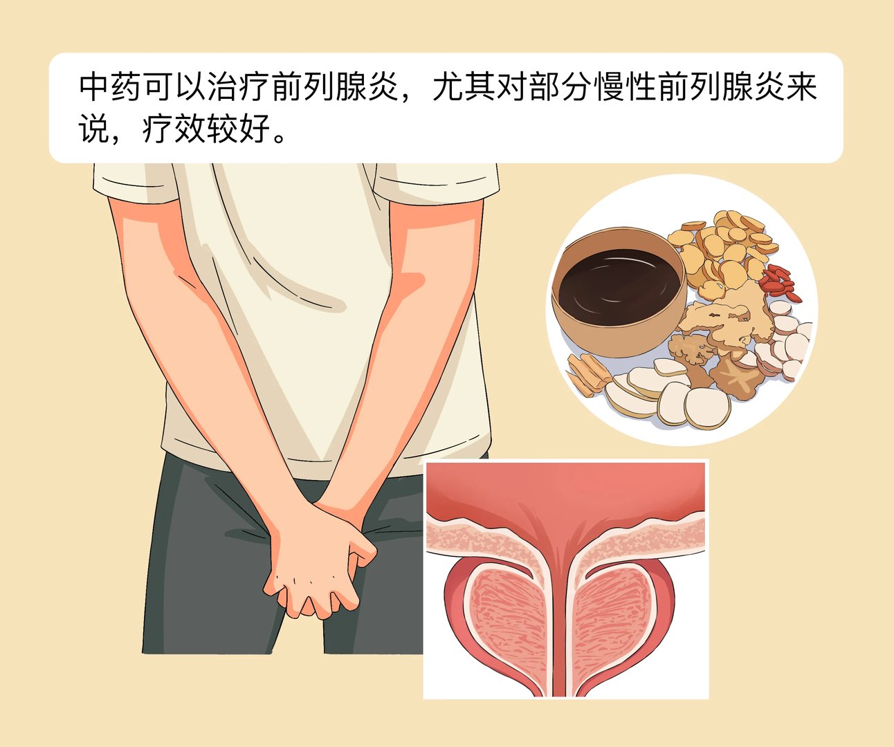 中药能治前列腺炎吗