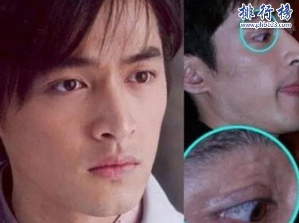 娱乐圈十大承认整容明星，最后一个让人唏嘘不已