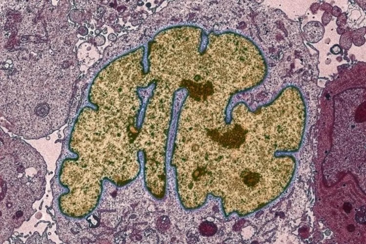 癌细胞是什么样子图片