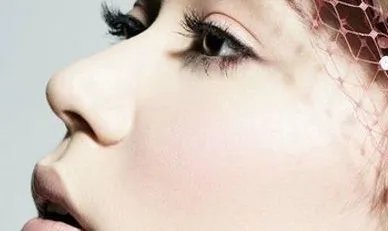 假体隆鼻整形上海哪家医院好