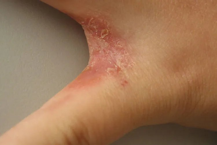 手气图片大全图片