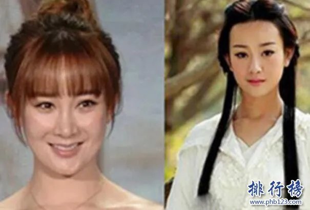 娱乐圈十大承认整容明星，最后一个让人唏嘘不已