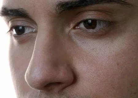 隆鼻术手术医院哪家好