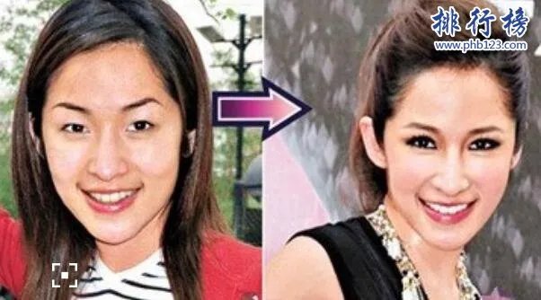娱乐圈十大承认整容明星，最后一个让人唏嘘不已