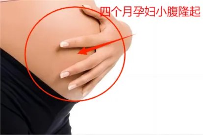 四个月孕妇小腹隆起图