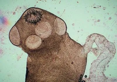 丙肝窗口期怎么检查